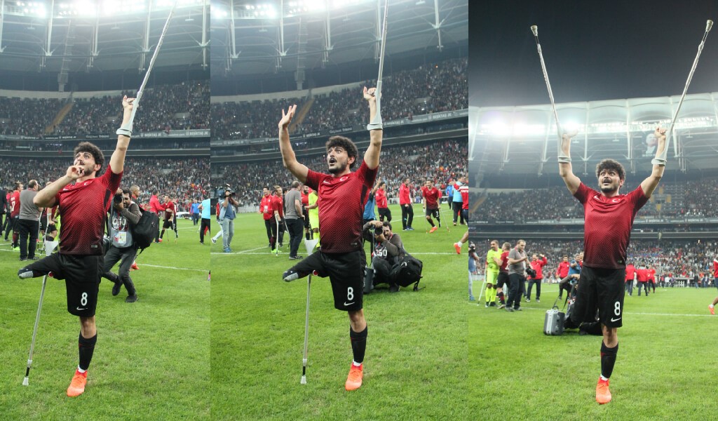 ampute_05 avrupa ampute futbol şampiyonası